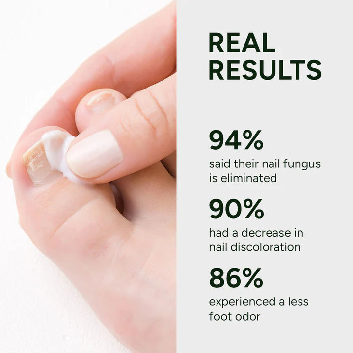 Nail Fungus Treatment Gel